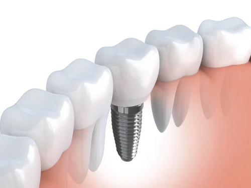 Neu Family Dental Picture 5
