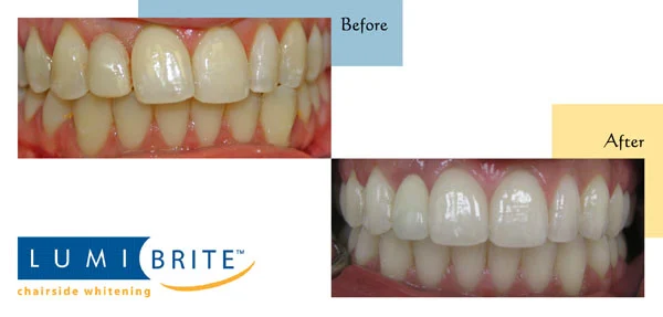 White River Family Dentistry Picture 6