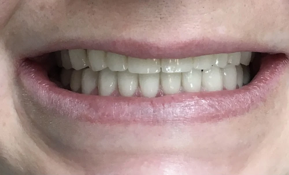 Newnan Dental Care Center Picture 4