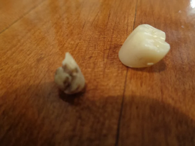 Dental Care of Stratford Picture 7