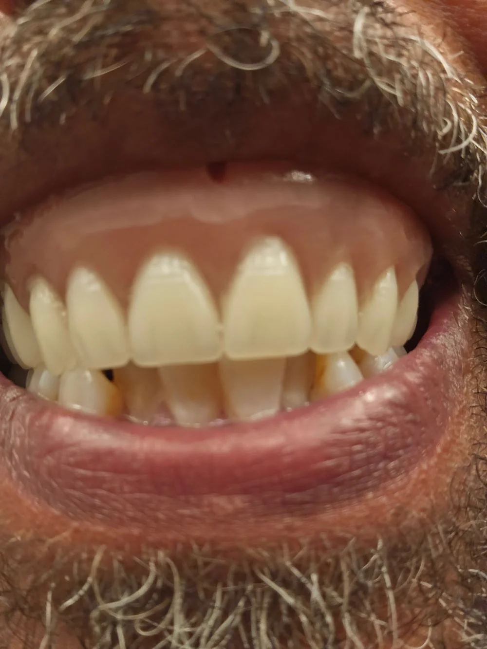 Affordable Dentures & Implants Picture 2