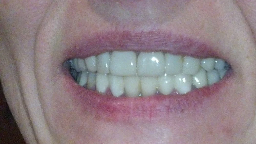 DentaLux LLC, Jennifer Donskoy DDS Picture 2