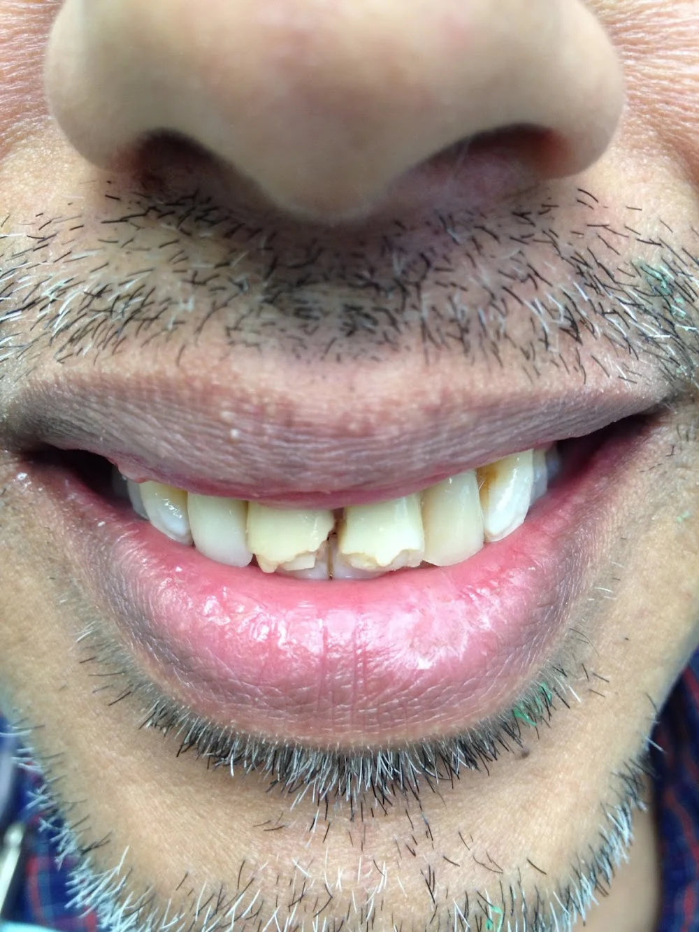 DentaLux LLC, Jennifer Donskoy DDS Picture 8