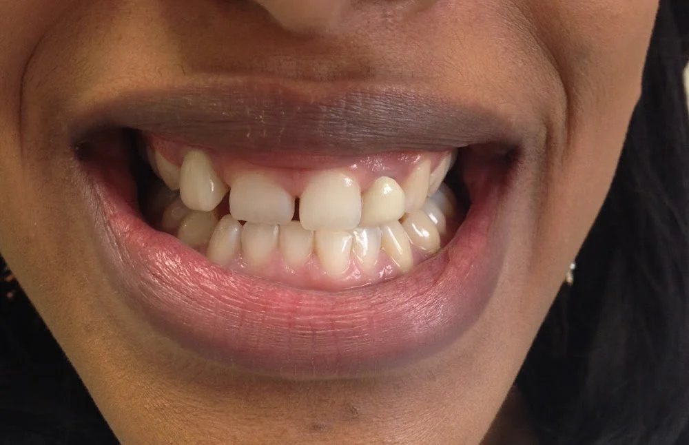 DentaLux LLC, Jennifer Donskoy DDS Picture 9
