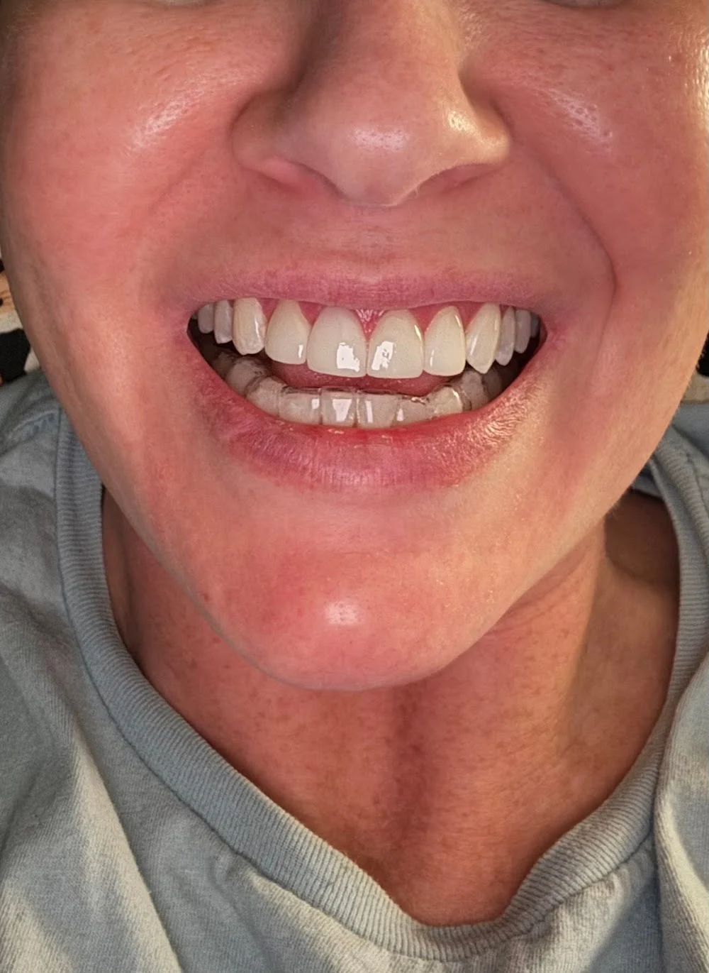 Haines Family Dental Picture 10