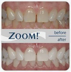 Afton Family Dental Picture 9