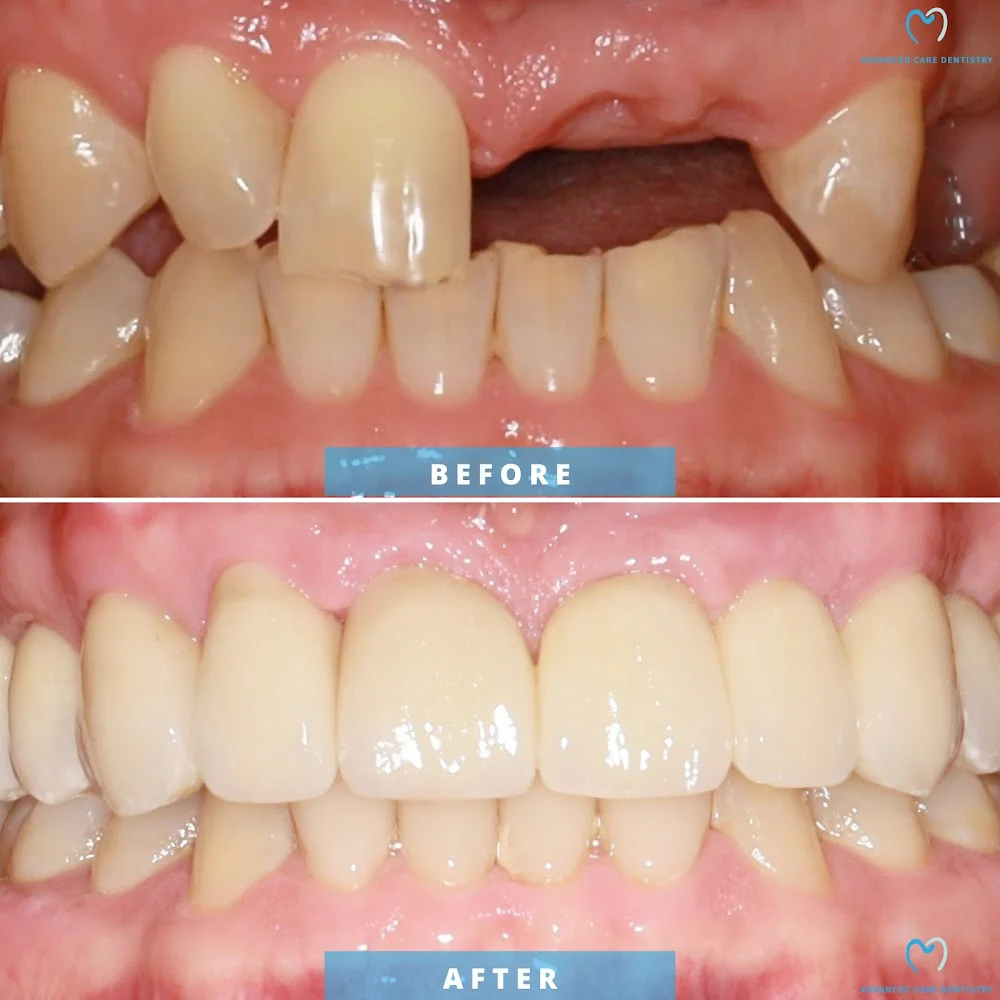 Advanced Care Dentistry Picture 7