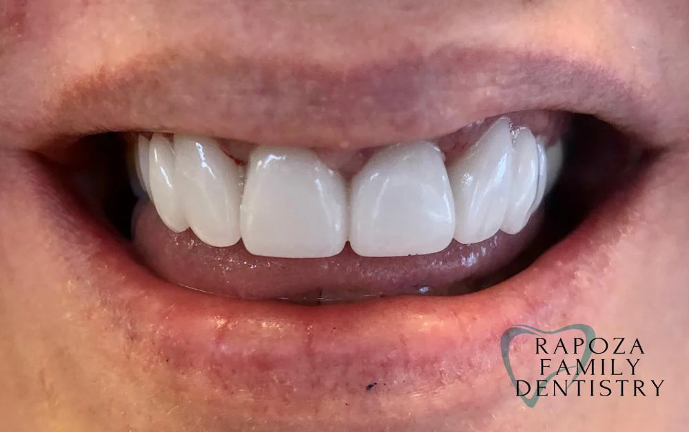 Rapoza Family Dentistry - Dr. Judee Hashem-Rapoza, DMD Picture 7