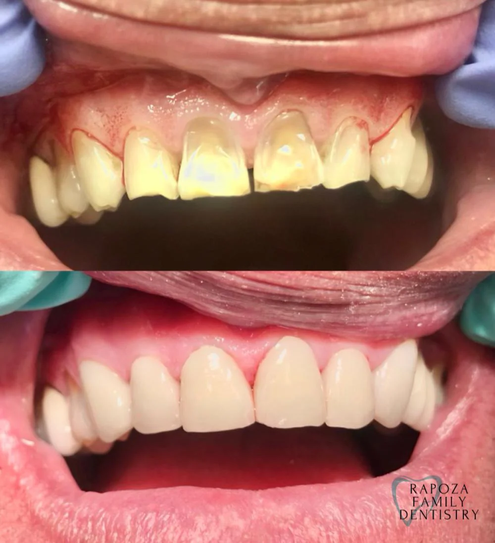 Rapoza Family Dentistry - Dr. Judee Hashem-Rapoza, DMD Picture 3