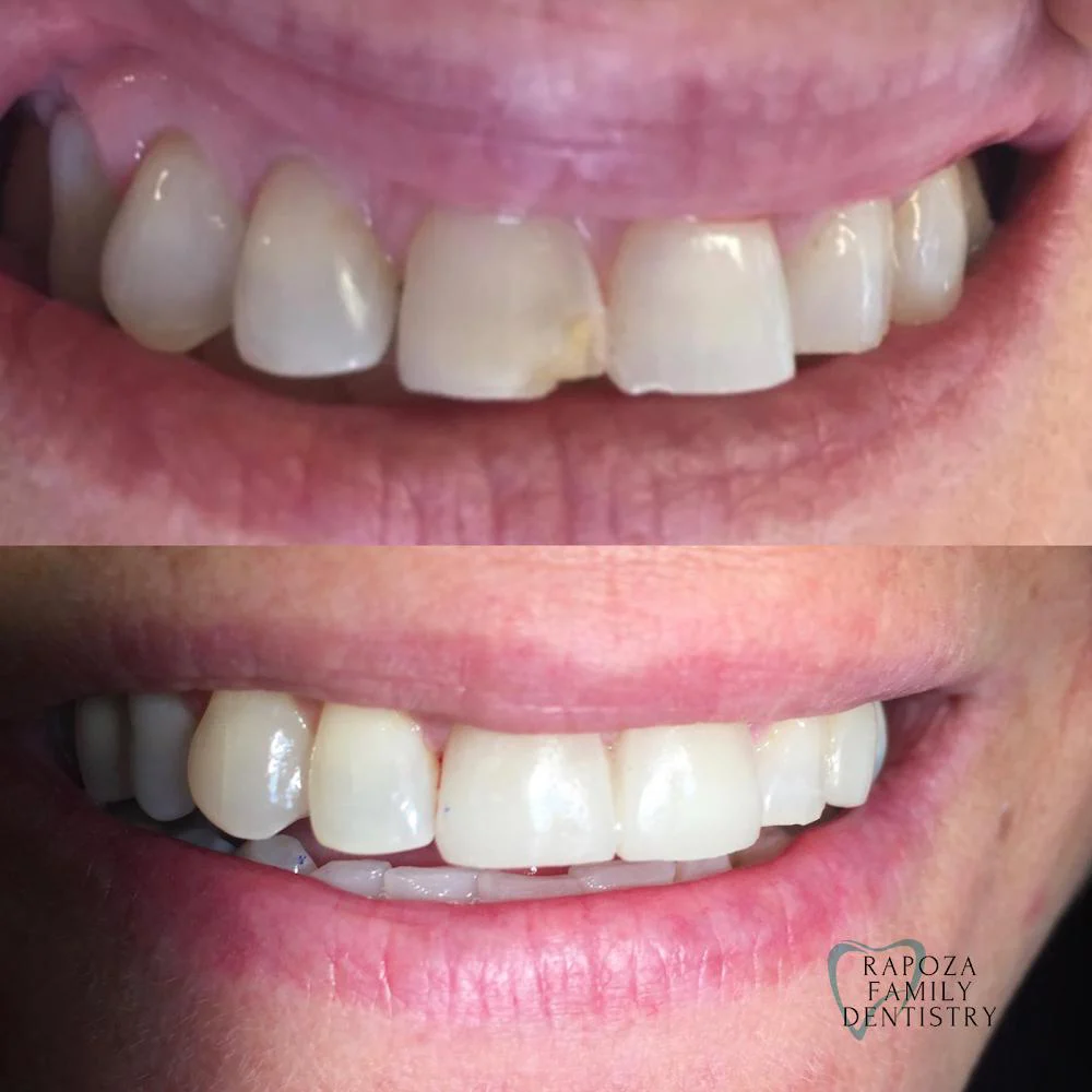 Rapoza Family Dentistry - Dr. Judee Hashem-Rapoza, DMD Picture 8