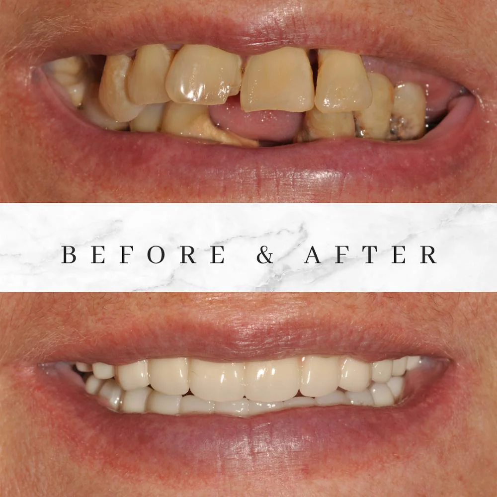 Summit Dental and Implant Clinic Picture 4