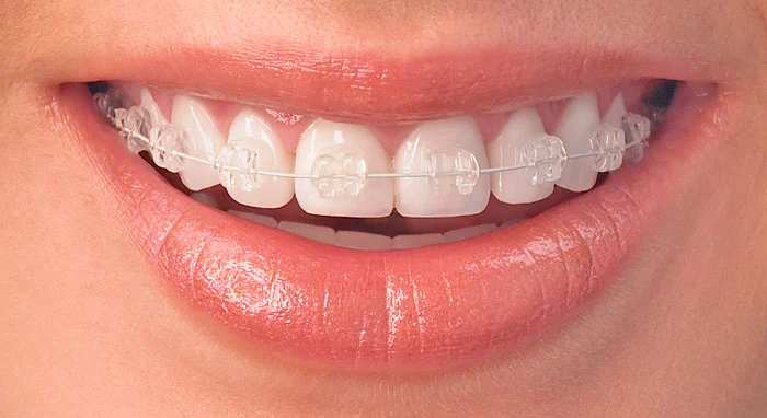Kaplin Orthodontics Picture 3