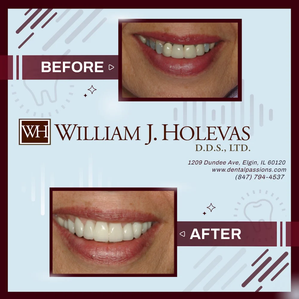 William J. Holevas D.D.S., LTD. Picture 4