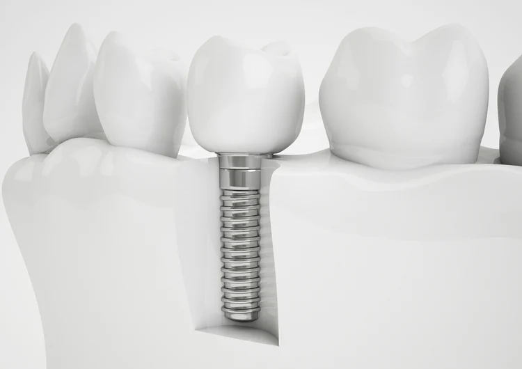 Mckenzie Family Dentistry Picture 8