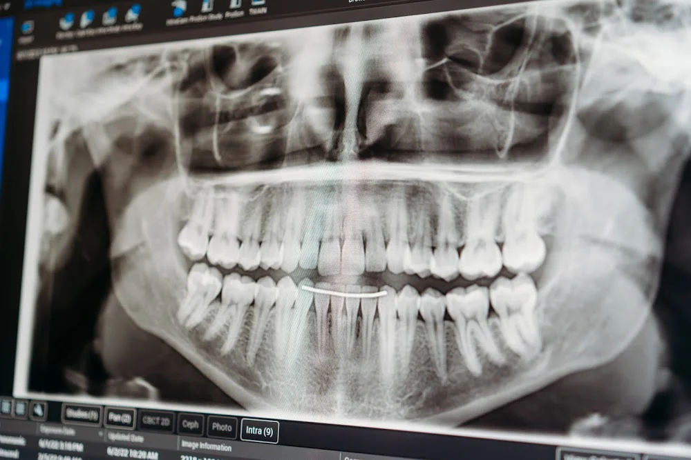 ConfiDENT Dental Cumming Picture 10