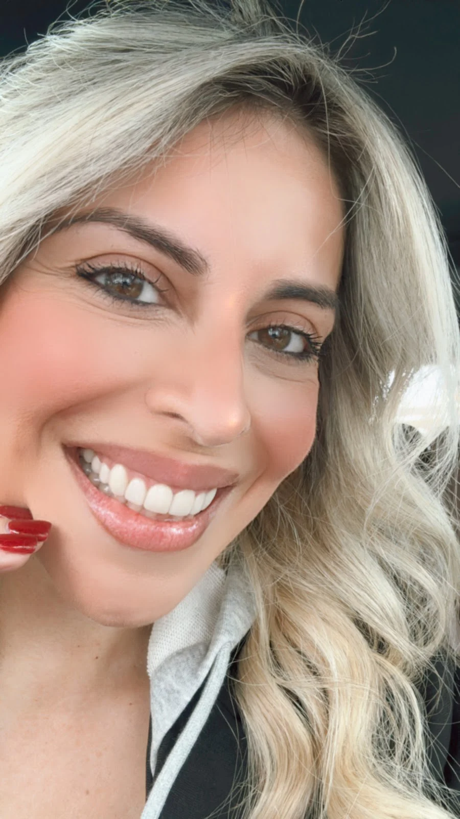 Complete Dental Care of Naples Picture 7