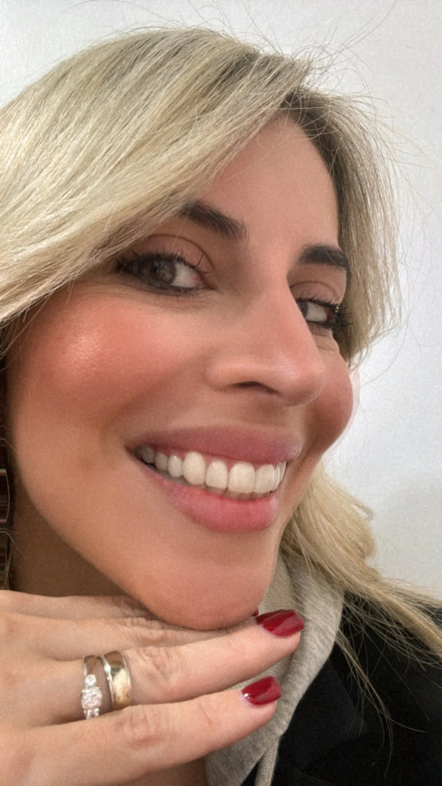Complete Dental Care of Naples Picture 6