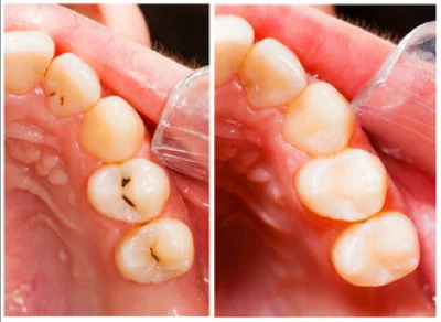 Dr. Melba P. Bonelli, DMD Picture 7