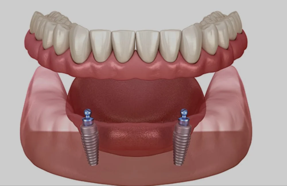 Naples Dental Boutique Picture 1