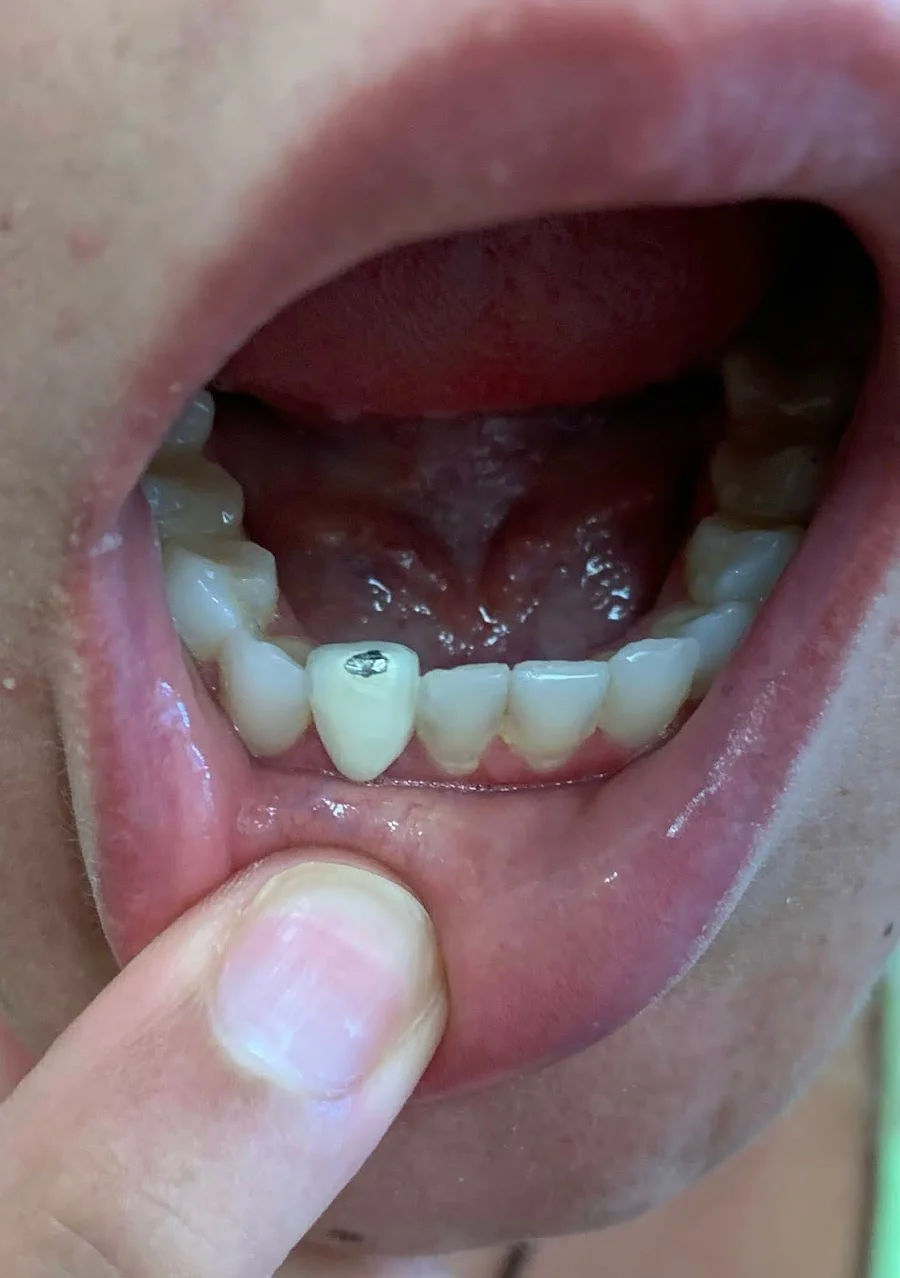 Dental Solutions of Blackwood Picture 5