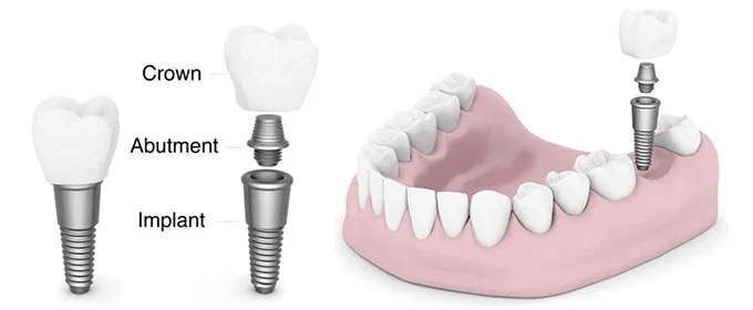 Naples General & Cosmetic Dentistry LLC Picture 10