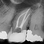 North Penn Endodontics Group