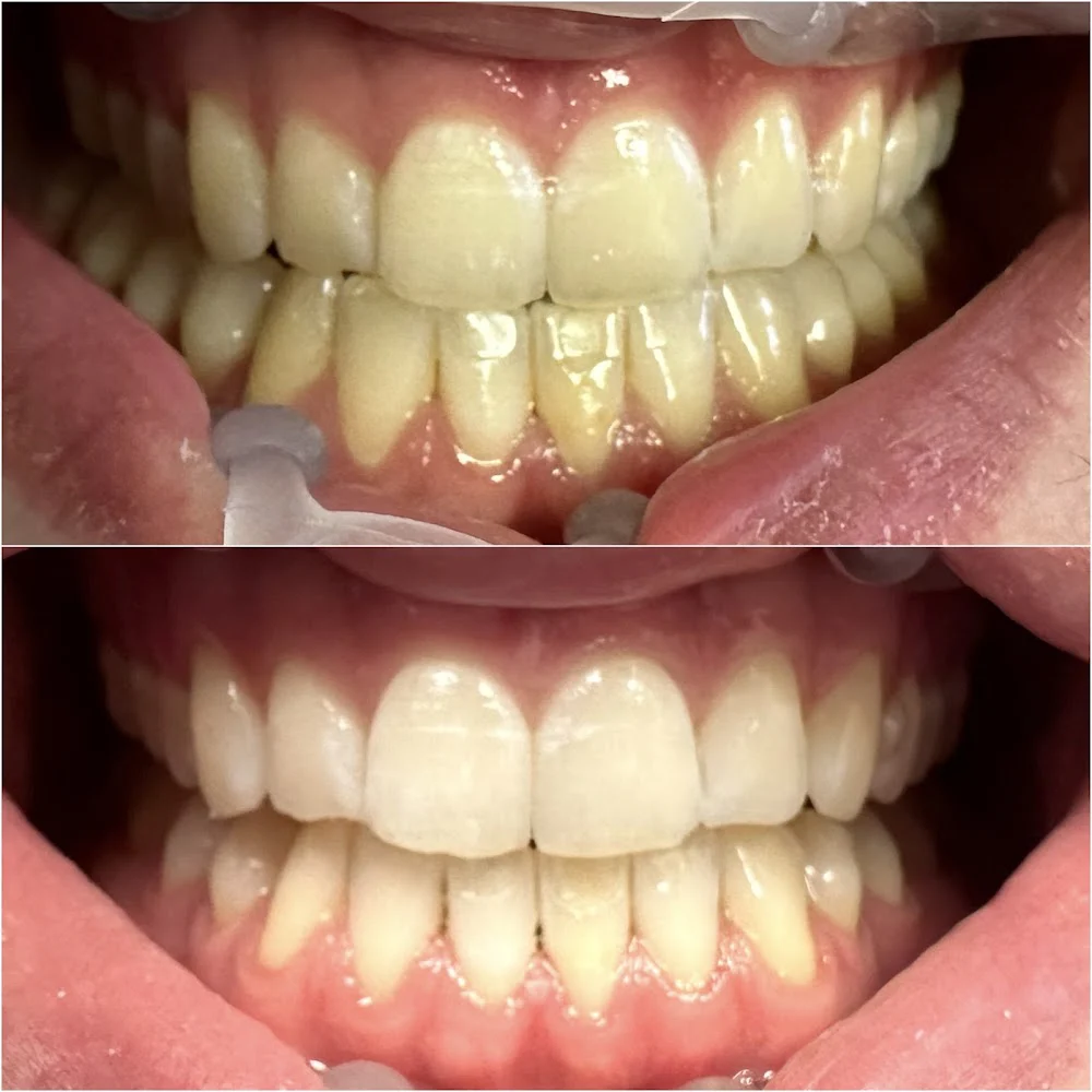 Abrams Family Dentistry Picture 6