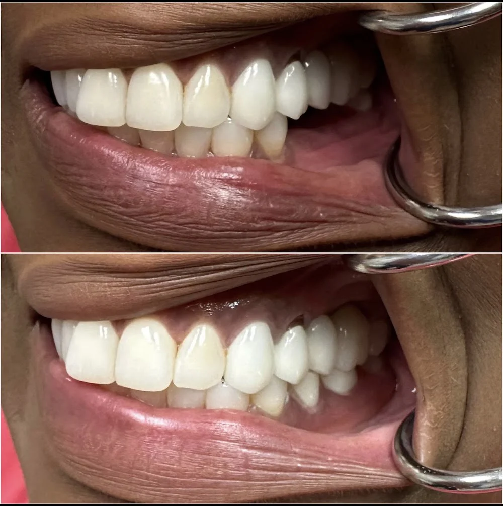 Abrams Family Dentistry Picture 8