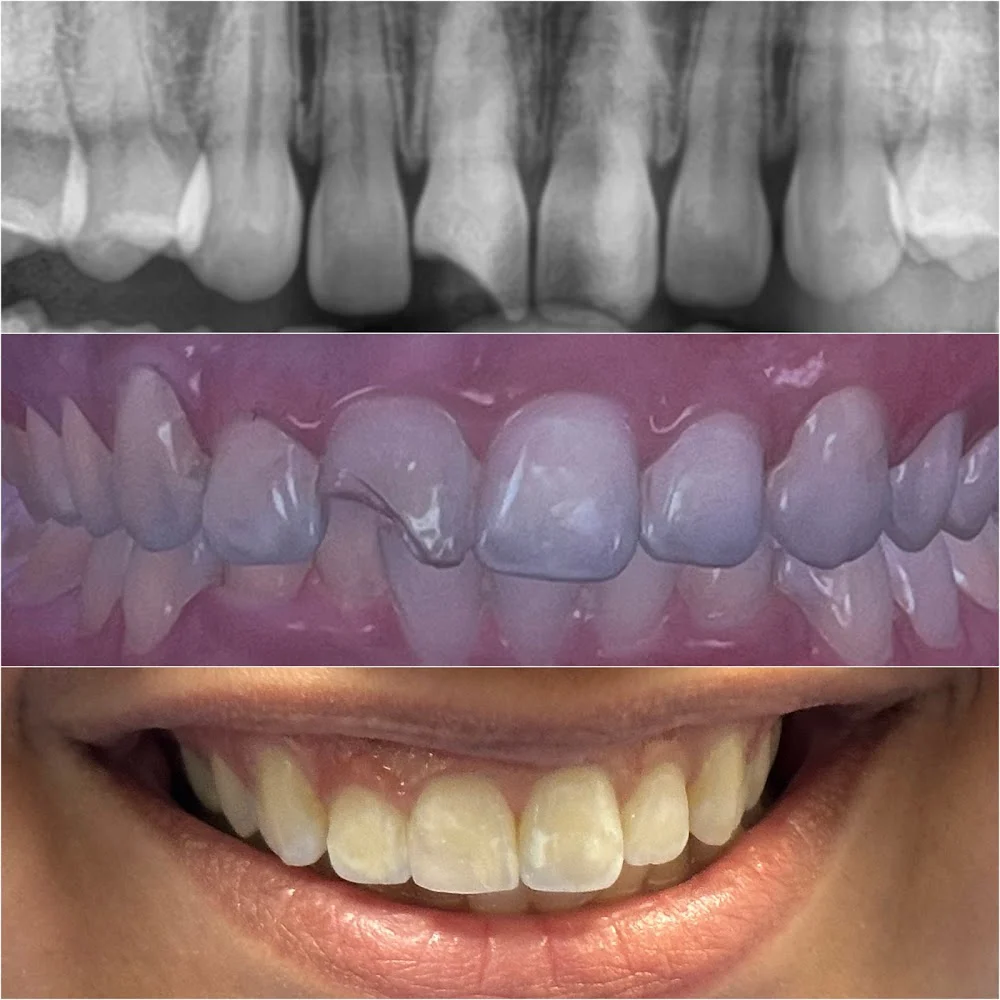 Abrams Family Dentistry Picture 7