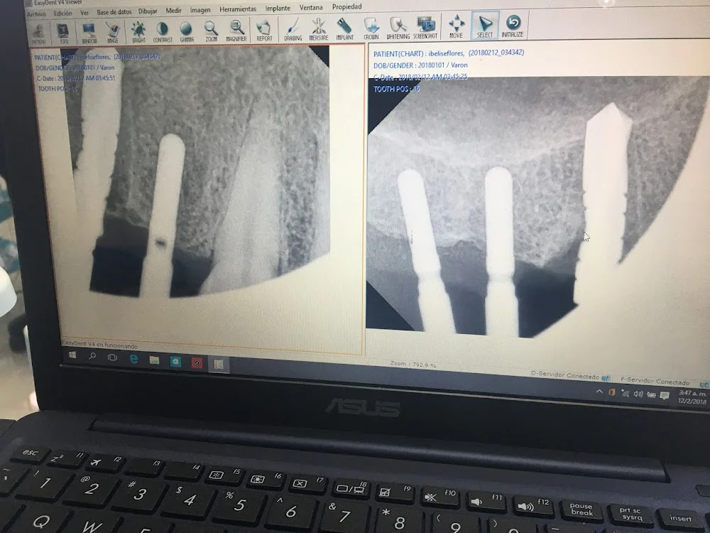 Dental Implant Solutions Kinnelon, NJ Picture 3