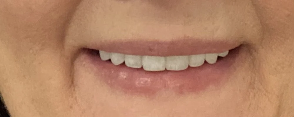 Paula S Gould DDS Cosmetic & Implant Dentistry Picture 7