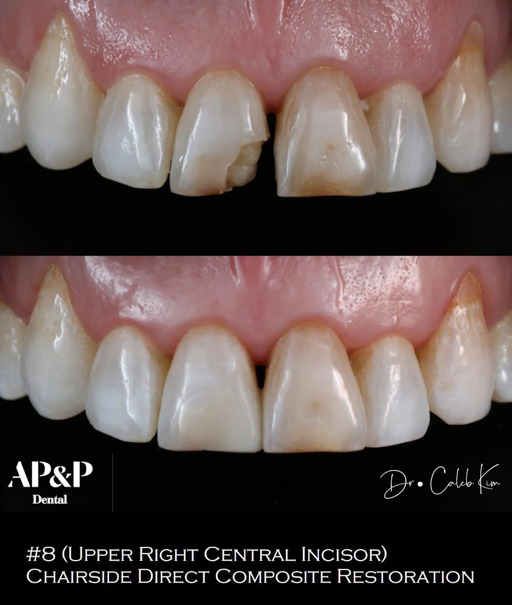 AP&P Dental - Advanced Prosthodontics & Periodontics Picture 4