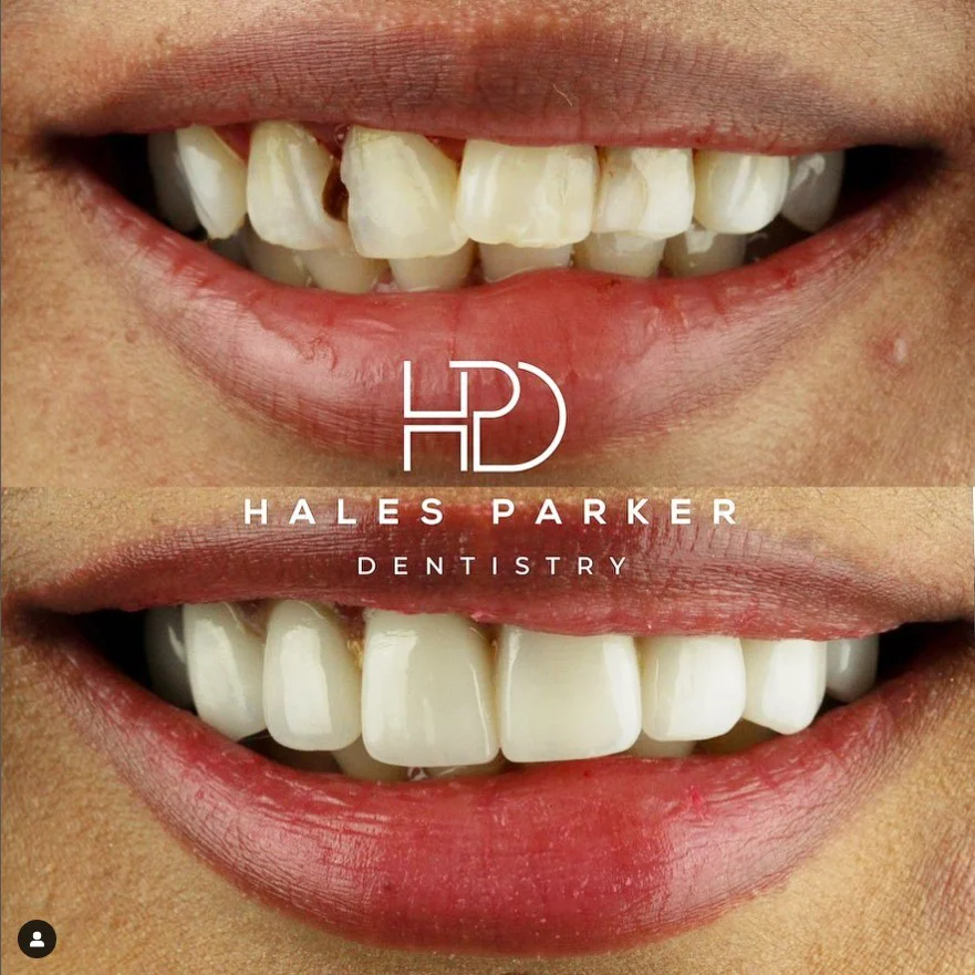 Facer Hales Parker Dentistry Picture 2
