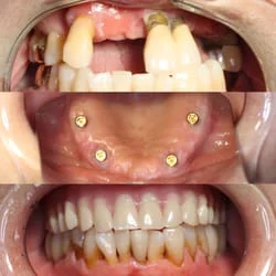 Blessed Smile Dentistry of Mission Viejo Picture 2