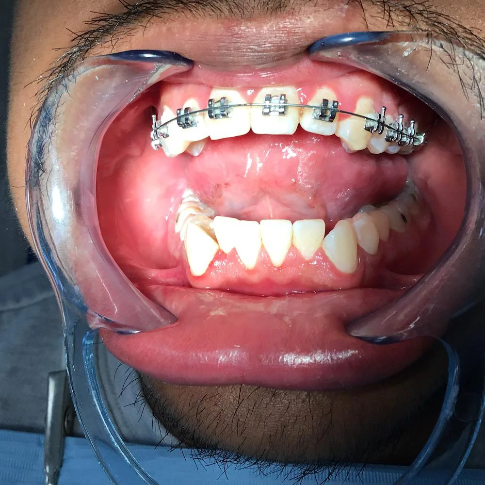 Super Smile Orthodontics - Orthodontist & Invisalign in Corona Picture 4