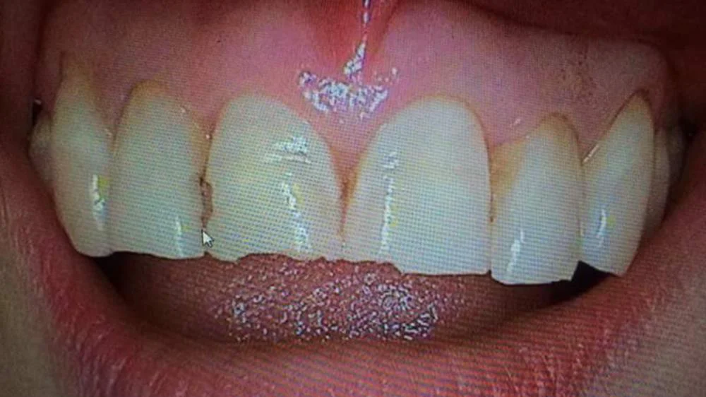 California Dentistry and Orthodontics Picture 6