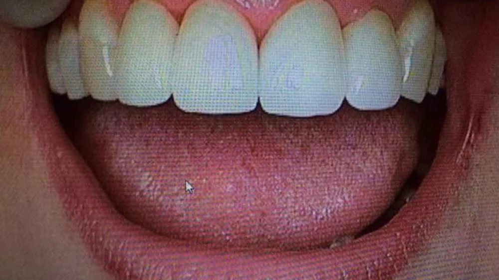 California Dentistry and Orthodontics Picture 10