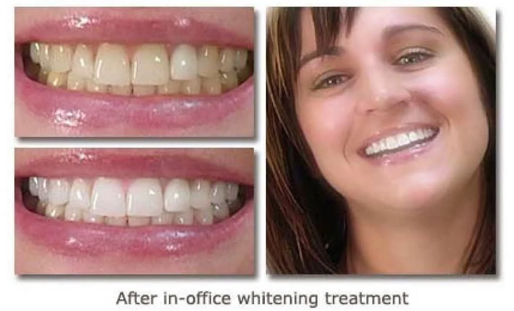 ACE DENTAL Picture 2
