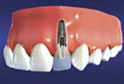 ACE DENTAL Picture 3