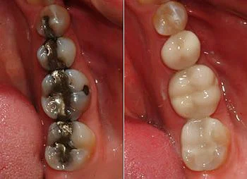 ProSmile Dentistry: Parisa Zarbafian DDS Picture 1
