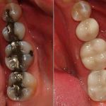 ProSmile Dentistry: Parisa Zarbafian DDS