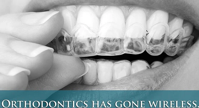 ProSmile Dentistry: Parisa Zarbafian DDS Picture 8