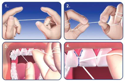 ProSmile Dentistry: Parisa Zarbafian DDS Picture 4