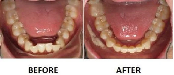 ProSmile Dentistry: Parisa Zarbafian DDS Picture 5