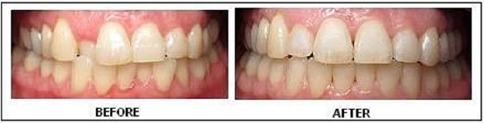 ProSmile Dentistry: Parisa Zarbafian DDS Picture 7