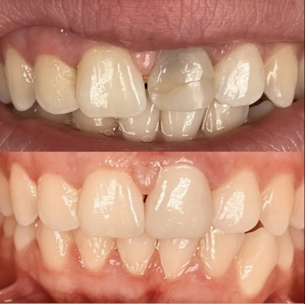 Smile Design Dentistry & Implant Center Picture 7