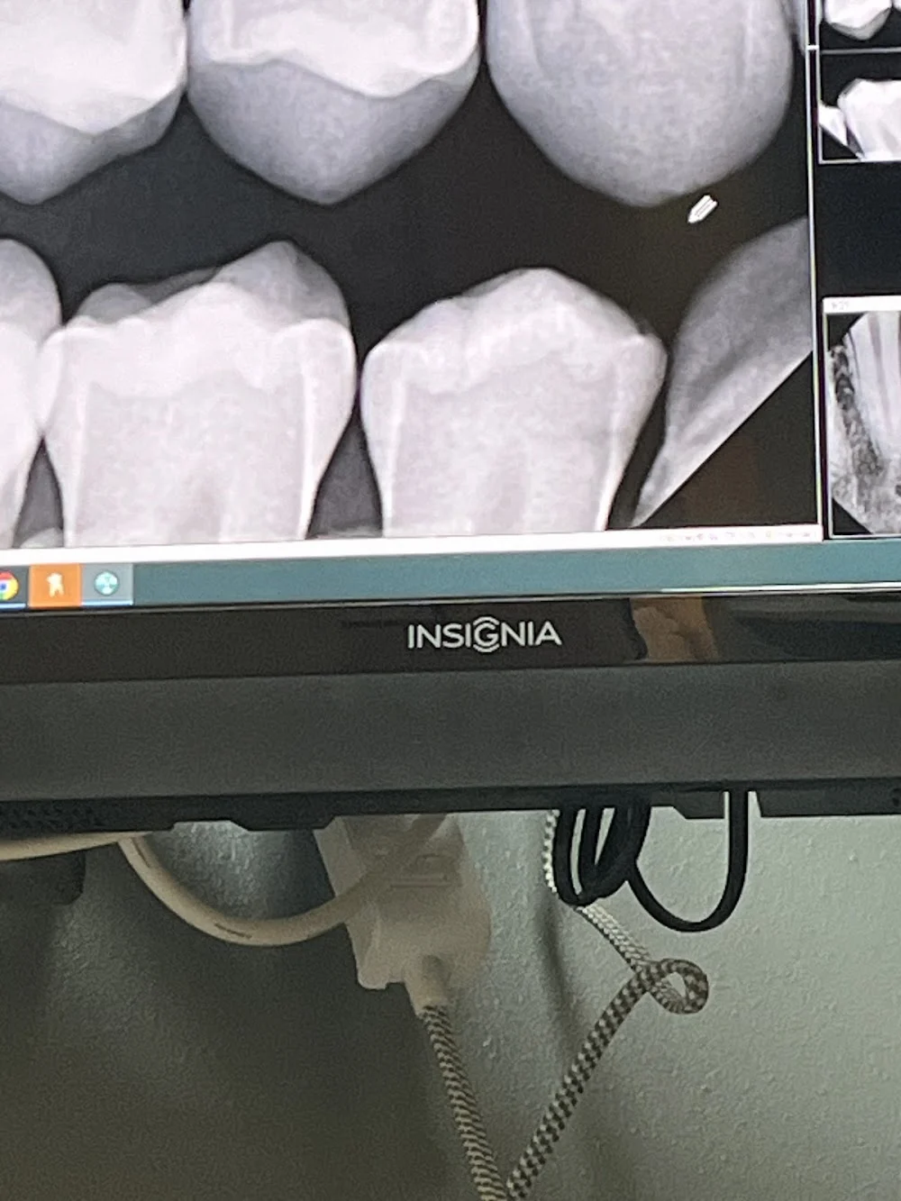 Rialto Dental Care Picture 7