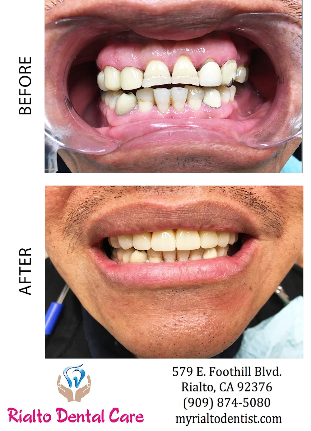 Rialto Dental Care Picture 9