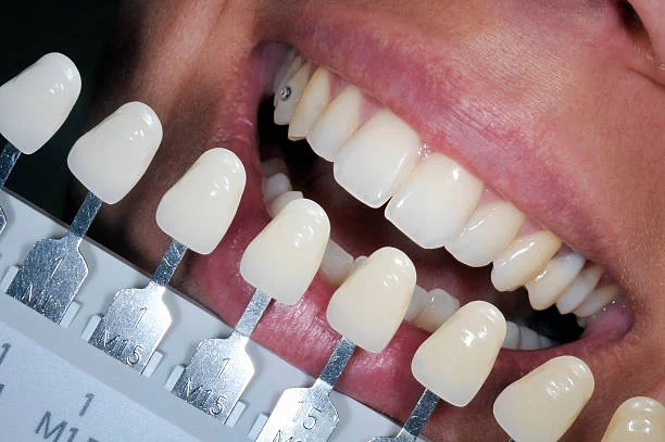Malibu Teeth Whitening, Inc Picture 10