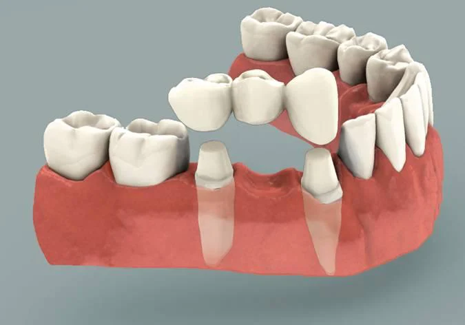 Baker Ranch Dental Spa & Implant Center Picture 2